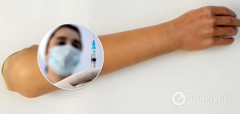В Италии мужчина пытался получить прививку от COVID-19 в силиконовую руку, но его разоблачили. Фото